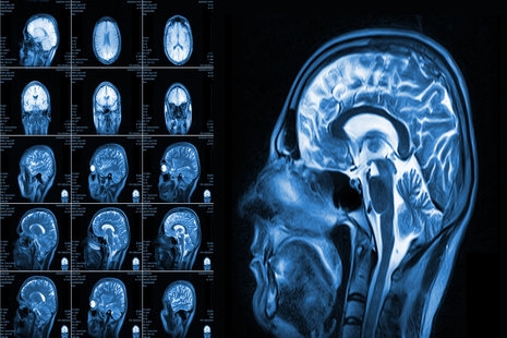 New Study Suggests the Human Brain Stays Alive For Hours After Death