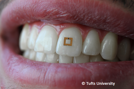 Tufts University in Massachusetts Develops Miniature Tooth Sensor to Measures Sugar, Salt, and Alcohol Intake