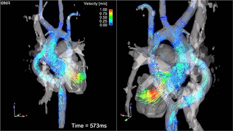 4-D MR imaging offers new insight previously unavailable with other diagnostic tests