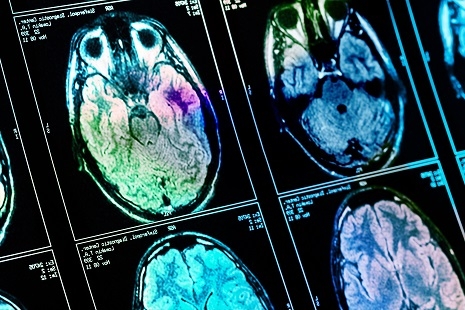 Facebook and NYU Want to Speed up MRI Scans