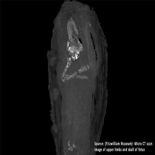 CT scans equip archeologists with ability to peer into wrapped mummies without harm