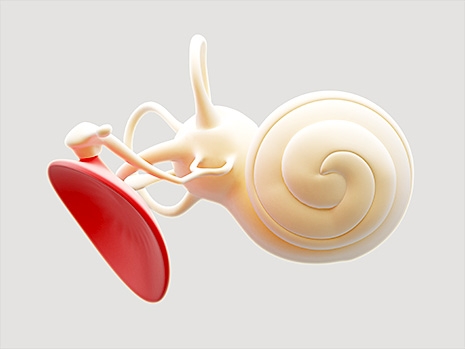 A Research Team Has Developed 3D Resin Ossicular Implants to Help with Hearing Loss