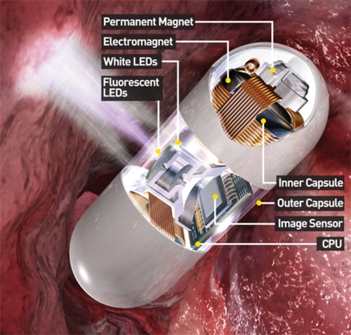 Camera capsules are a less invasive diagnostic imaging option