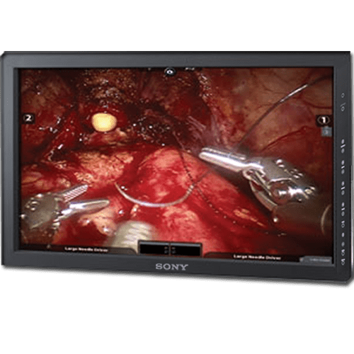 Sony's LMd3251mt Medical Display