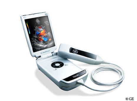 GE unveils the second generation of their compact Vscan Ultrasound