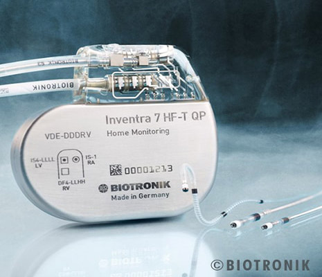  Biotronik announces the sole 42 joule implantable cardioverter defibrillator (ICD) in the US
