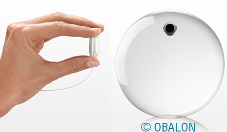 Non-invasive weight loss treatment from Obalon Therapeutics, Inc. receives FDA approval
