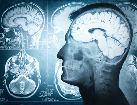 Researchers at Cardiff University have made an evolutionary discovery about the ever growing human Brain