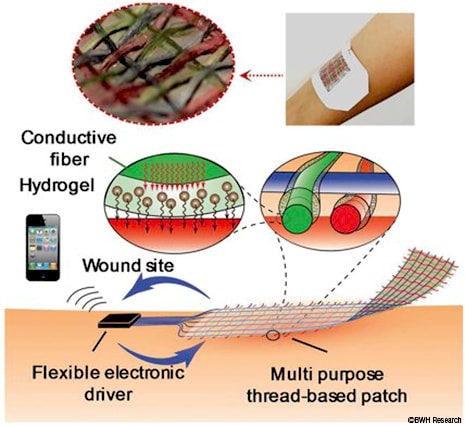 Researchers at the University of Nebraska-Lincoln, Harvard Medical School, and MIT have collaborated to create the world’s first “smart bandage” 