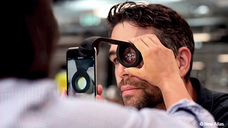oDocs Smartphone Ophthalmoscope allows eye exam access in developing nations 
